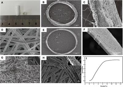 A small-diameter vascular graft immobilized peptides for capturing endothelial colony-forming cells